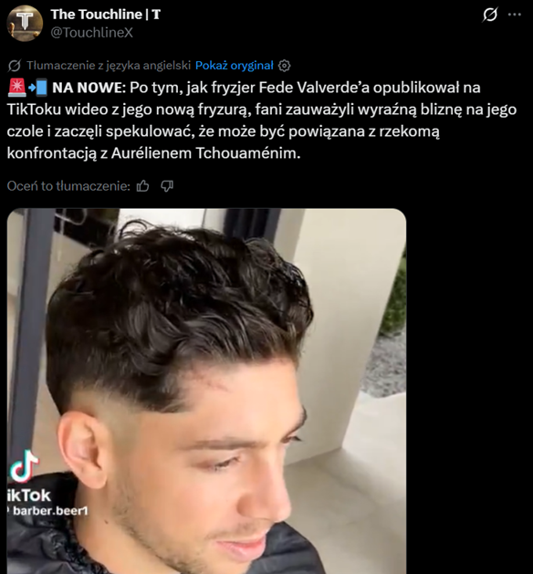 Nowa FRYZURA Fede Valverde i WIDOCZNA BLIZNA po majowym starciu z Tchouamenim!